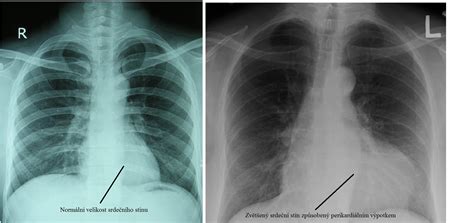 Rentgen hrudníka psa s kardiomegaliou