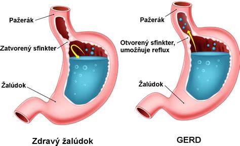 schematický obraz refluxu u psa: pažerák a žalúdok