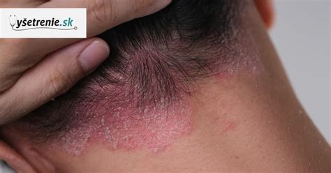 Pes s kožnými problémami