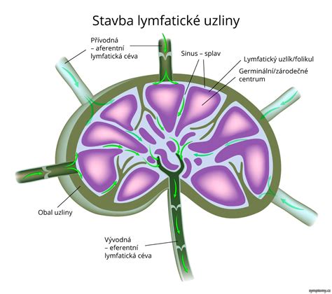 ultrazvukový obraz zväčšenej lymfatickej uzliny u psa
