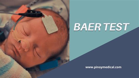 Infografika o testovaní sluchu u psov (BAER test)