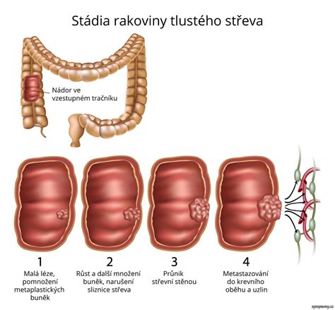 Schéma tráviaceho traktu psa s vyznačenými potenciálnymi miestami zablokovania kostí