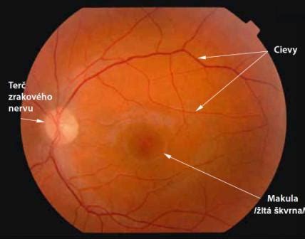 Očné pozadie psa s hypertenziou