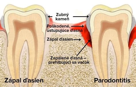 Štruktúra zuba a parodontálne tkanivá