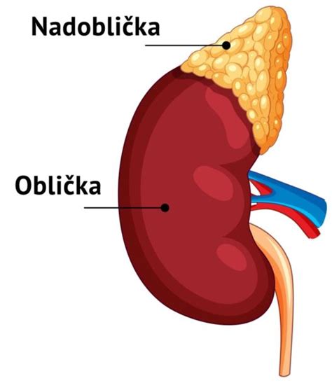 infografika porovnávajúca zdravé nadobličky a nadobličky postihnuté Cushingovým syndrómom