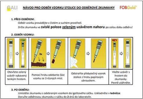 Ilustrácia majiteľa psa ako drží vzorku stolice v nádobe