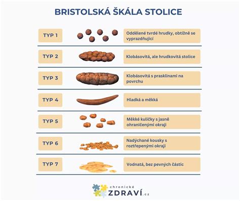 zdravá psí stolica