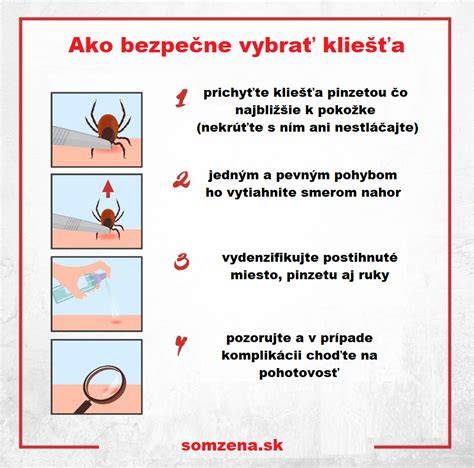 Obrázok: Ako správne odstrániť kliešťa pinzetou