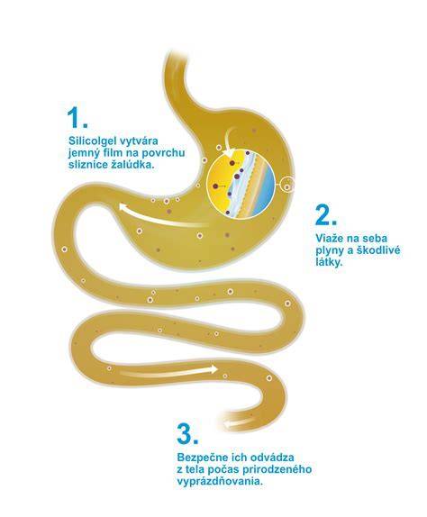 Infografika: Základné mechanizmy torzie žalúdka a postupy liečby