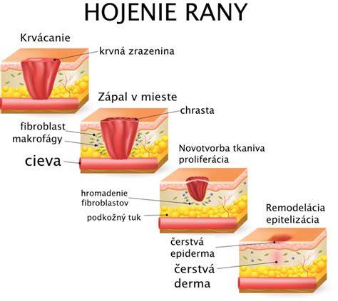 Infografika: Fázy hojenia rany a debridgement