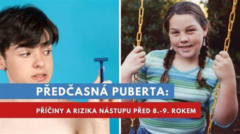 Infografika: Puberta psa a vlákna vývoja mozgu