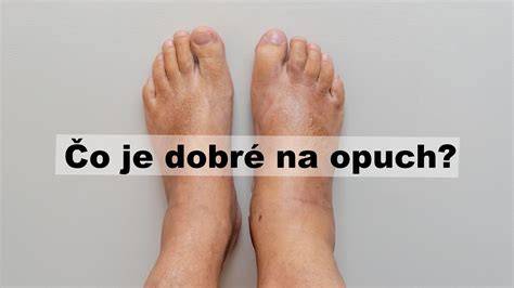Grafická schéma: Možné príčiny opuchu zadnej nohy a diagnostické kroky