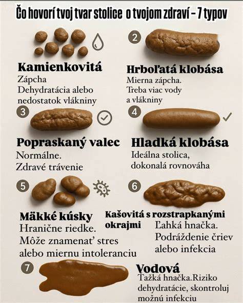 Obrázok infografiky: typy stolice psov a čo znamenajú
