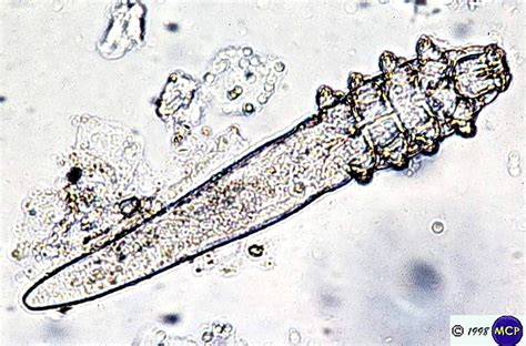 Mikroskopický snímok roztoča Demodex canis