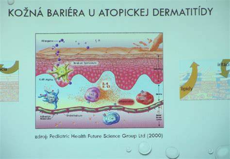 Schéma liečby atopickej dermatitídy u psa