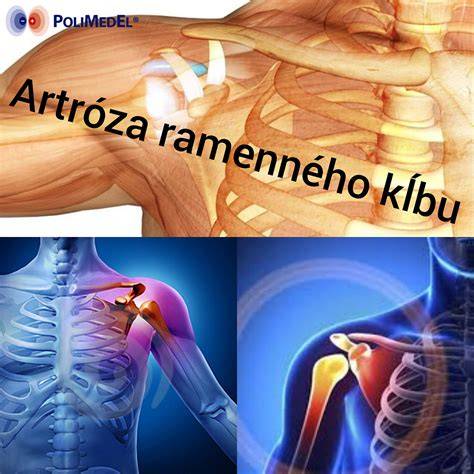 tagimg: Graf štruktúry svalového tkaniva a jeho zmeny pri sarkopénii