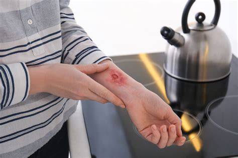 Obrázok znázorňujúci stupne hypotermie a správnu prvú pomoc
