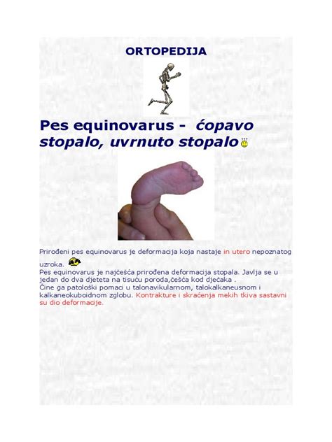 Štruktúra chodidla s pes equinovarus