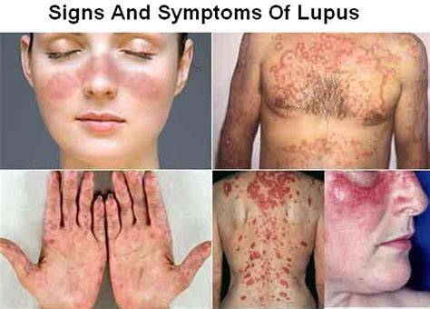 Ilustračná mapa regiónu Lipche Lupus a okolia