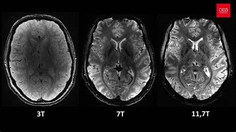 CT a MRI snímky mozgu