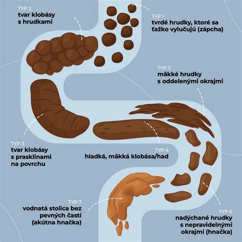 Infografika: Ako vyzera zdrava stolica psa a co sledovat