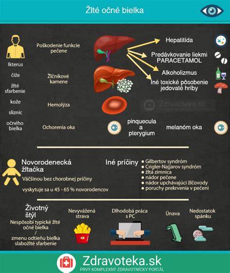Infografika: Najčastejšie príčiny ničenia psov a tipy na prevenciu