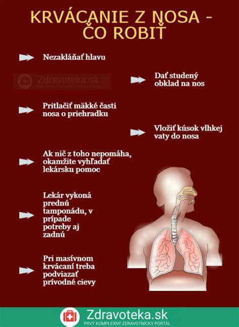 Infografika: čo robiť pri bodnutiach a uštipnutiach