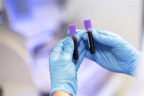 Schéma prenosov a prevencia kliešťových chorôb