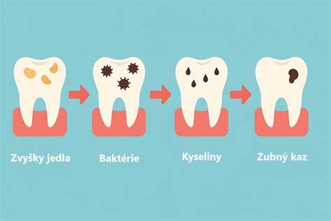 Infografika: Ako vzniká zubný kameň a jeho dopady na zdravie psa