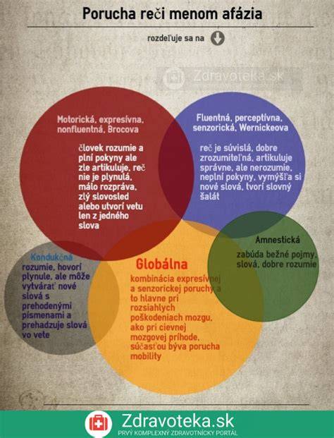 Infografika: Rozdelenie vhodných men a ich zvučnosť