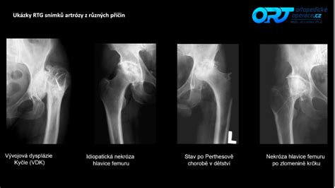RTG snímok psa s dyspláziou kyčle