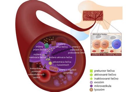 Grafické znázornenie príčin glykozúrie