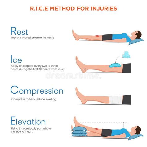 Infografika: RICE protokol pre psov (Rest, Ice, Compression, Elevation)