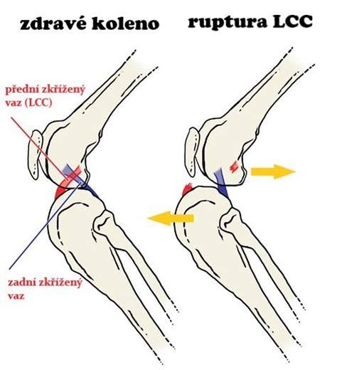 Infografika: anatomia kolena psa a stabilita väzív