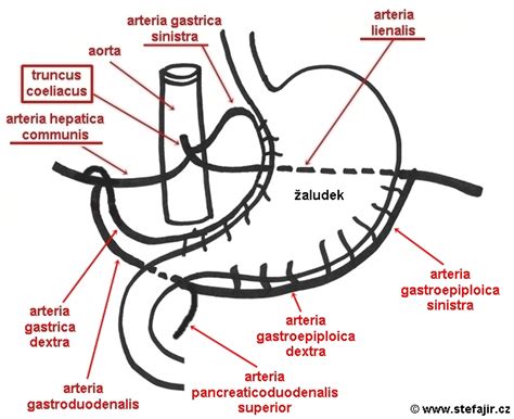 Schéma torzie žalúdka a gastropexie