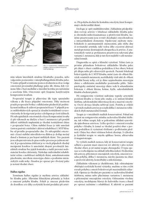 Infografika: PEC - zložky deformity, diagnostika a liečebné postupy