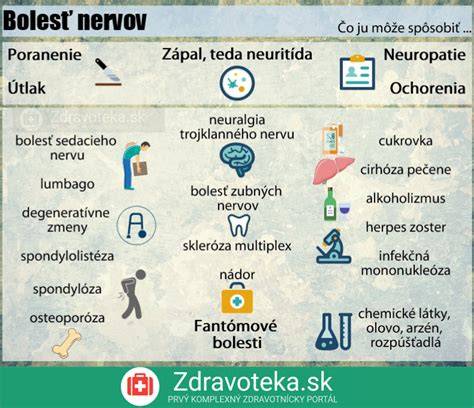 Infografika: priebeh divertikulitídy a možné komorbidity (zobrazuje rozloženie divertík a potenciálne príčiny bolesti)