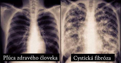 Infografika: Základné genetické ochorenia labradora a ich sledovanie
