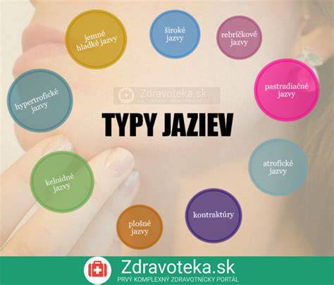 Infografika: Prehľad typov špicov a ich materiálov