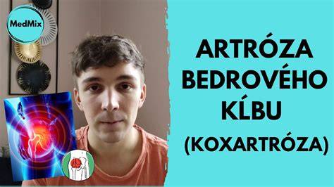 Diagrama: Norbergov uhol, stavba bedrového kĺbu a kategorizácia DBK
