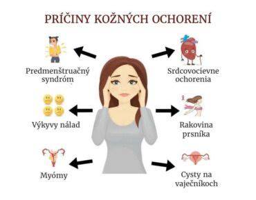 Infografika: Cesta kožných ochorení od príčiny po liečbu