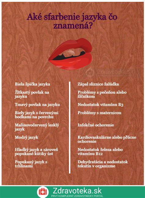 Infografika: Neverejné znaky psieho jazyka a chvosta