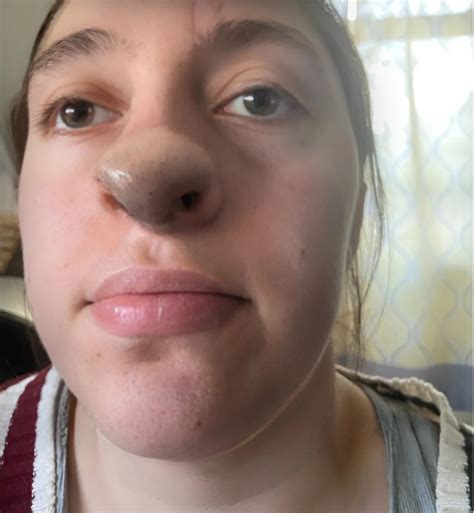 mladá žena po útoku psa