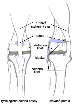 Anatomické znázornenie luxácie pately u psa